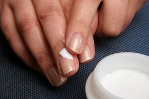 Behandlung von Nagelpilz mit Salbe
